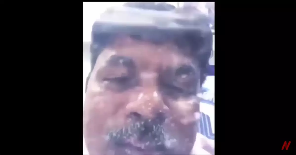 Hello I Am Under The Water Meme Download Video